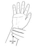 Location of P6 acupoint stimulation
(Source: Anesthesiology 2005;102:1046)