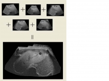 多个超声资料进行拼接