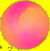 Normal intestinal image after having its hue, saturation and intensity analysed by the system