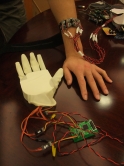 By attaching the surface electromyography sensor to the user's forearm, the system can control the robotic hand at the other end of the Internet