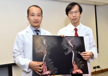 Dr. Thomas Leung (left), Lee Quo Wei Associate Professor of Neurology, Department of Medicine and Therapeutics; and Prof. Simon Yu, Professor, Department of Imaging and Interventional Radiology at CUHK, introduced the Carotid Angioplasty and Stenting (CAS).