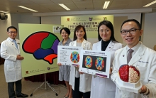 CUHK Medicine sets up the world’s first research registry on early onset dementia in the Chinese population, aiming to increase public knowledge of the disease.