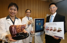 CUHK Faculty of Medicine conducts world’s largest study on epidemiology of NAFLD in diabetic patients, showing 1 in 5 is suffered from severe liver fibrosis or cirrhosis.  
(From left) Dr. Alice Pik Shan KONG, Associate Professor, Division of Endocrinology and Diabetes, Department of Medicine and Therapeutics; Dr. Vincent Wai Sun WONG, Professor, Division of Gastroenterology and Hepatology, Department of Medicine and Therapeutics; and Prof. Henry Lik Yuen CHAN, Director of the Institute of Digestive Disease.