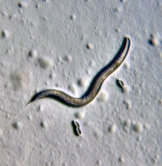 An adult C. elegans nematode (about 1 mm long) pictured with eggs