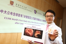 中大医学院院长暨卓敏内科及药物治疗学讲座教授陈家亮教授领导全球首项「针对亚士匹灵引致肠道出血」的数据分析。