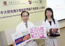 Studies by CUHK Faculty of Medicine reveal that 1 out of 5 non-obese subjects suffer from non-alcoholic fatty liver disease. Some may even develop severe liver fibrosis.