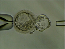 Pre-implantation genetic testing.