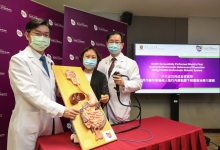 CUHK successfully performed world’s first colorectal endoscopic submucosal dissection using flexible endoscopic robotic system. 

(From left) Professor Philip Wai Yan CHIU, Director of the CUHK Jockey Club Minimally Invasive Surgical Skills Centre; Ms. Chan, participant of the clinical trial; and Professor Simon Siu Man NG, Professor of the Division of Colorectal Surgery, Department of Surgery at CU Medicine.