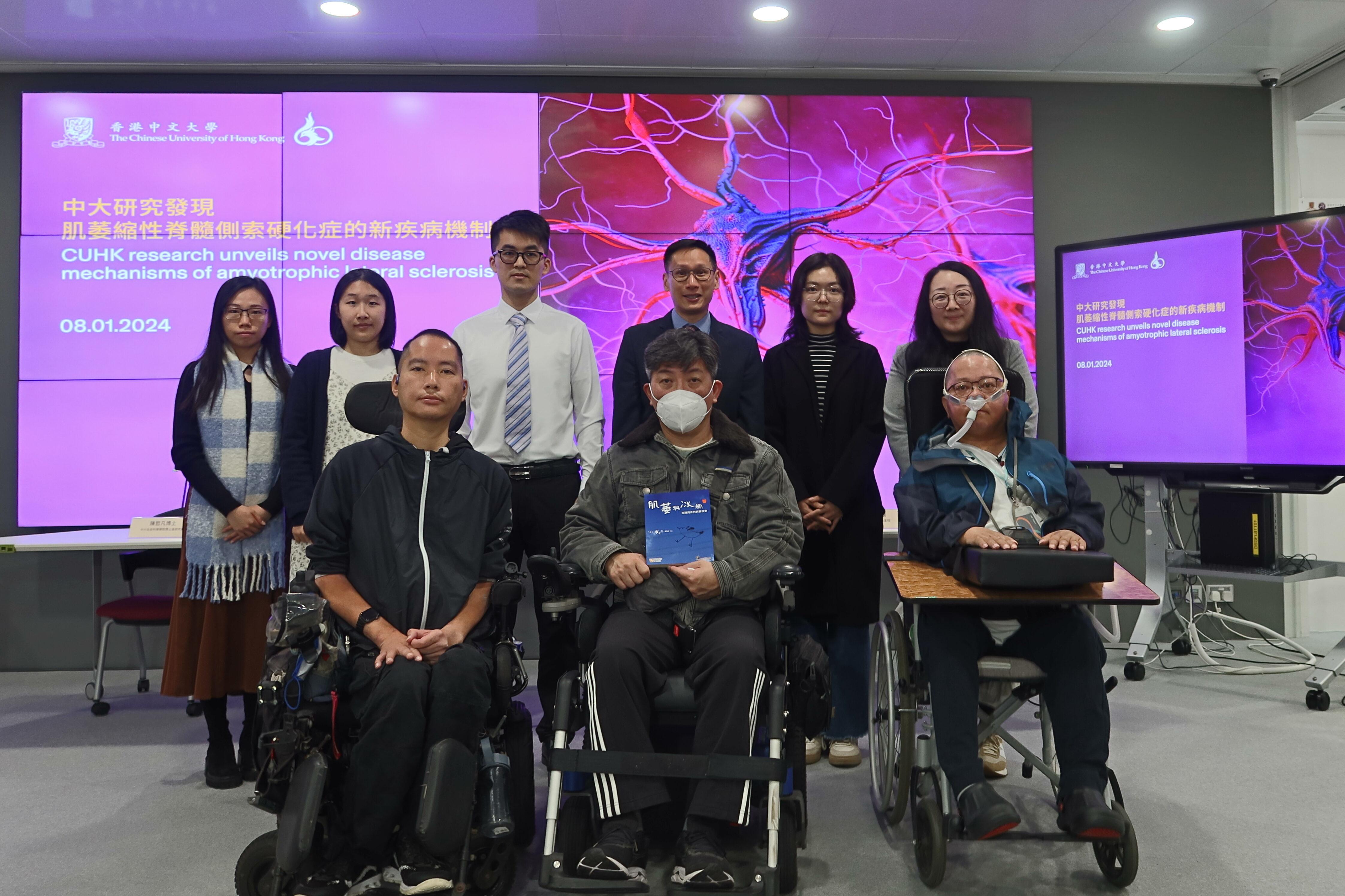 CUHK Research Unveils Novel Disease Mechanisms Of Amyotrophic Lateral cuhk-research-unveils-novel-disease-mechanisms-of-amyotrophic-lateral