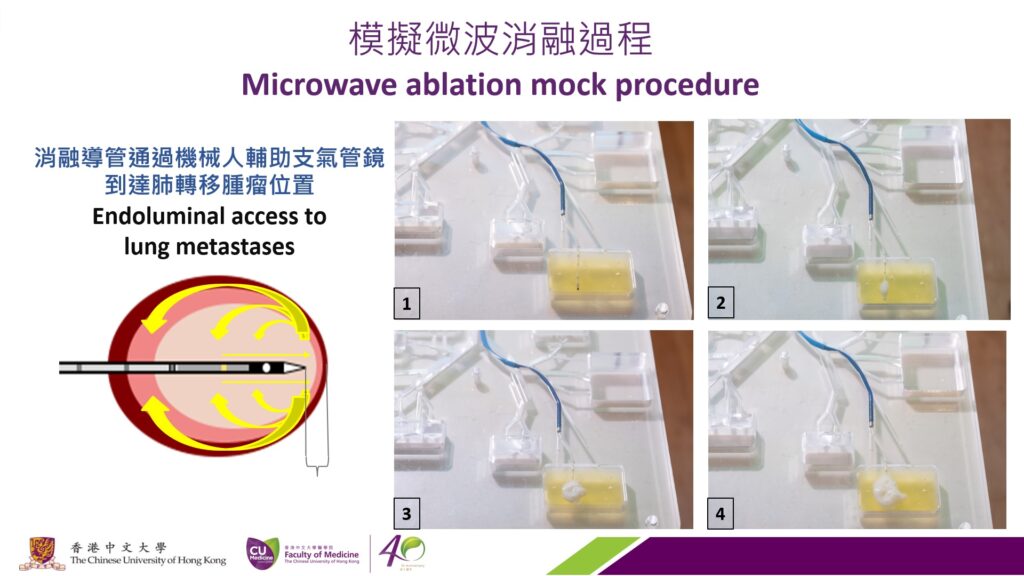 The diagram shows a mock procedure of microwave ablation with egg yolk. The endoluminal releases microwave and heat which can effectively destroy cancer cells at a temperature above 60°C.