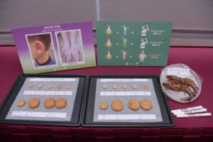 圖中顯示其中兩種蝦敏感測試方法，包括食物激發測試及血液特異性IgE檢測。