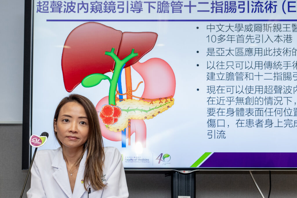 陳詩瓏醫生指，「超聲波內窺鏡引導下膽管十二指腸引流術」近乎無創，中大醫學院更是亞太區內應用這種治療的先驅之一。