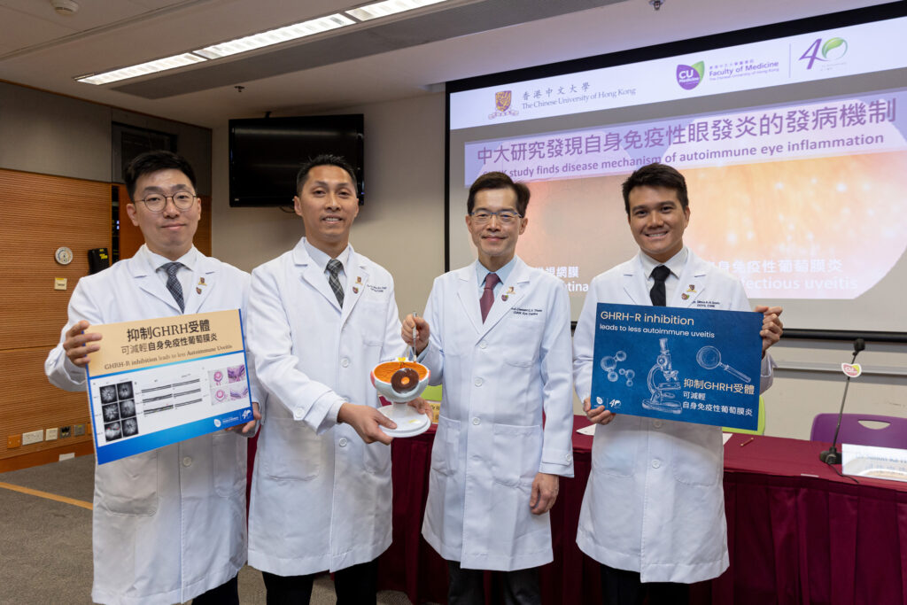 中大醫學院研究團隊破解自身免疫性葡萄膜炎的發病機制，並發現可抑制相關致病路徑的註冊藥物，有望成為新療法。<br />
左起：中大醫學院眼科及視覺科學學系博士後研究員杜林博士、研究助理教授朱偉傑博士、系主任兼何善衡眼科及視覺科學講座教授譚智勇教授及助理教授司徒家浩醫生。