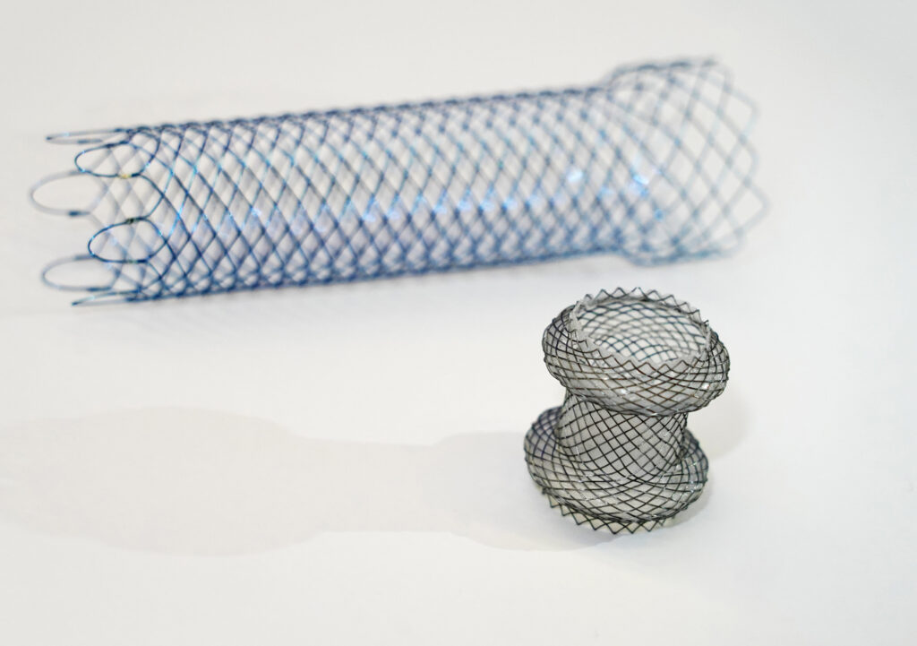 The EUS-GE procedure directly creates a connection between the stomach and the duodenum with a metal stent (front) using an endoscope under the guidance of ultrasound. The stent is not close to the tumour reducing the chance of tumour ingrowth. A specially designed stent is used that apposes the organs together and prevents migration. Duodenal stent used in conventional treatment is displayed at the back.