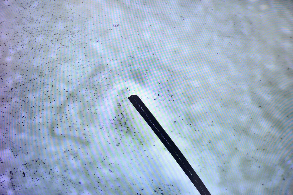 This photo illustrates the ratio of a human hair to nanobots (black dots).