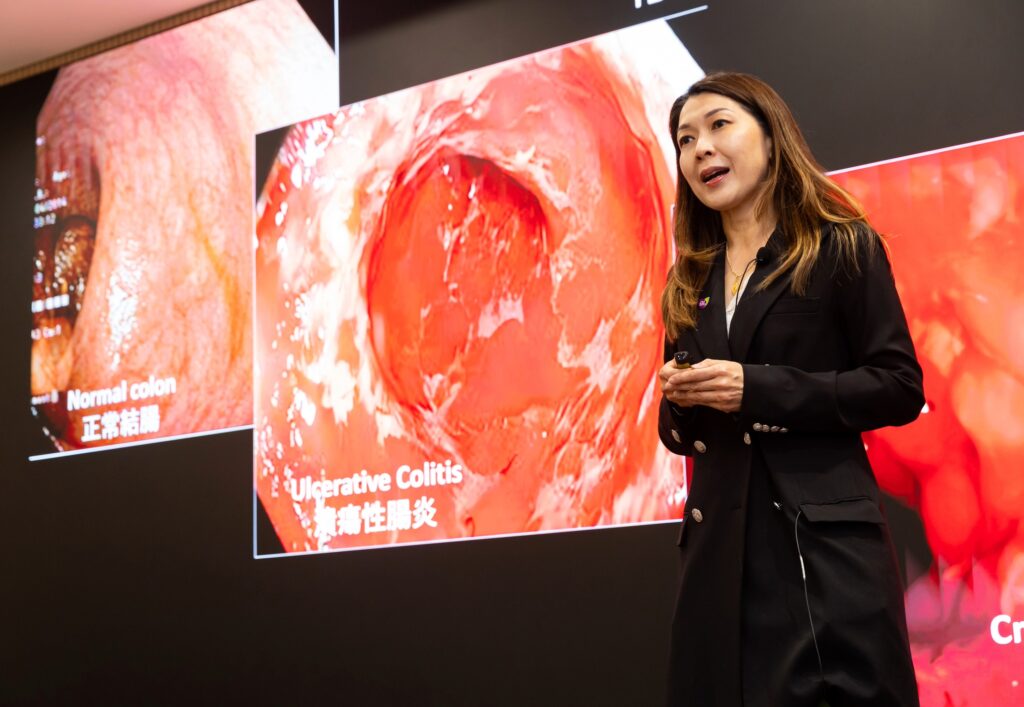 黃教授表示炎症性腸病的徵狀會終身伴隨患者，並指出香港已進入流行病學演變的第二階段，發病率持續上升。隨著本港炎症性腸病患者年長化，患者病情日益複雜，急需正視。