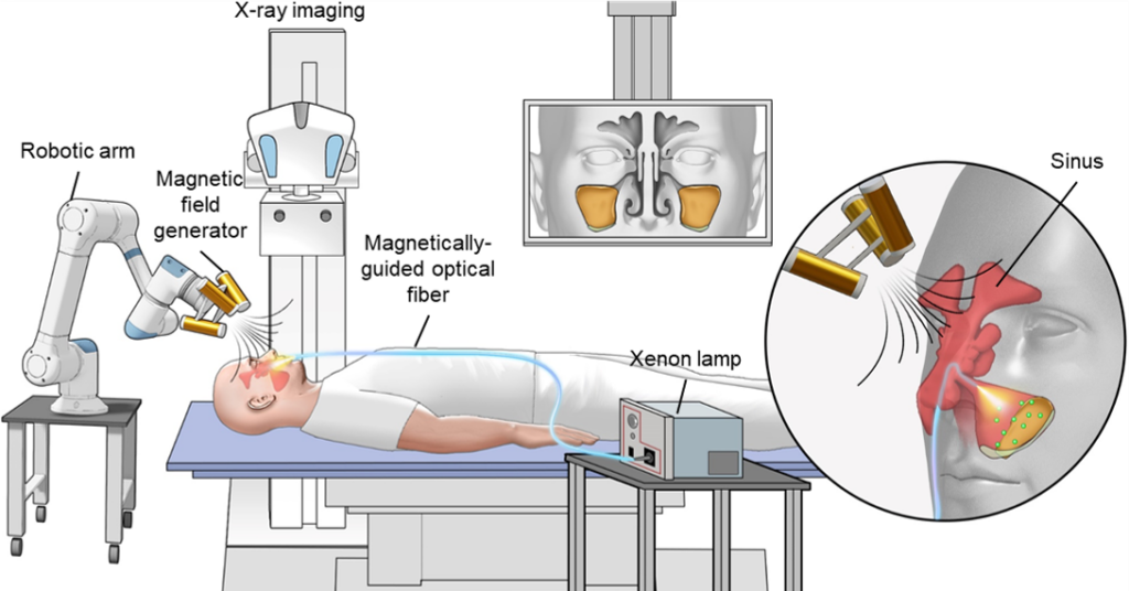 Under an external magnetic field, the microrobots swarm and navigate rapidly to infection sites. Visible light delivered via optical fibre activates antibacterial activity, enabling photothermal effects that reduce mucus viscosity and enhance penetration and generation of reactive oxygen species (ROS) for powerful biofilm disruption.