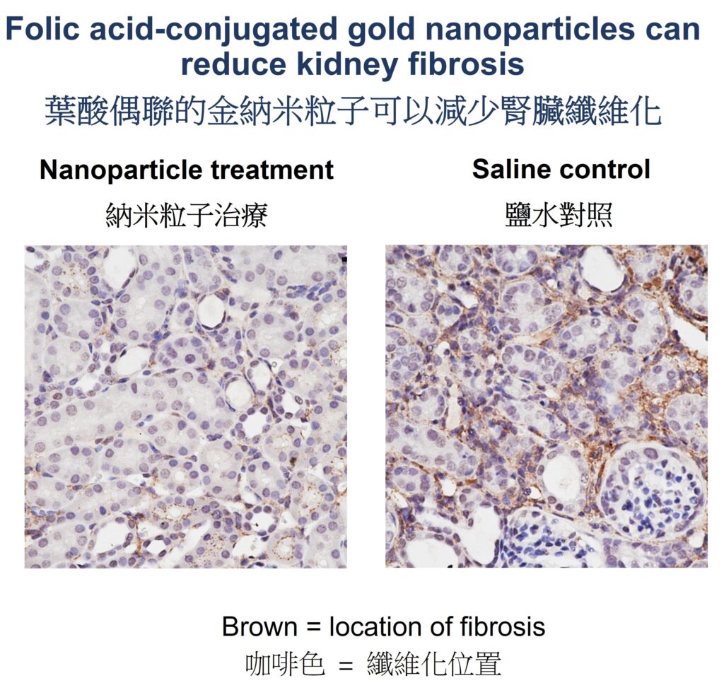 圖片顯示納米顆粒治療或鹽水對照後腎臟纖維化的位置（咖啡色）。