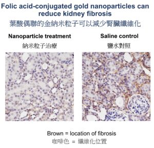 圖片顯示納米顆粒治療或鹽水對照後腎臟纖維化的位置（咖啡色）。